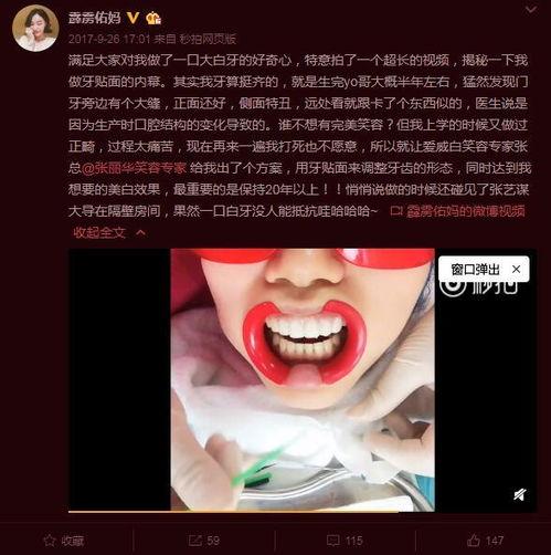 国际明星网红美牙机构,揭秘明星亮白笑容的秘密！